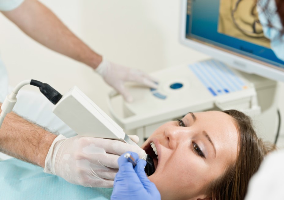 dental implants